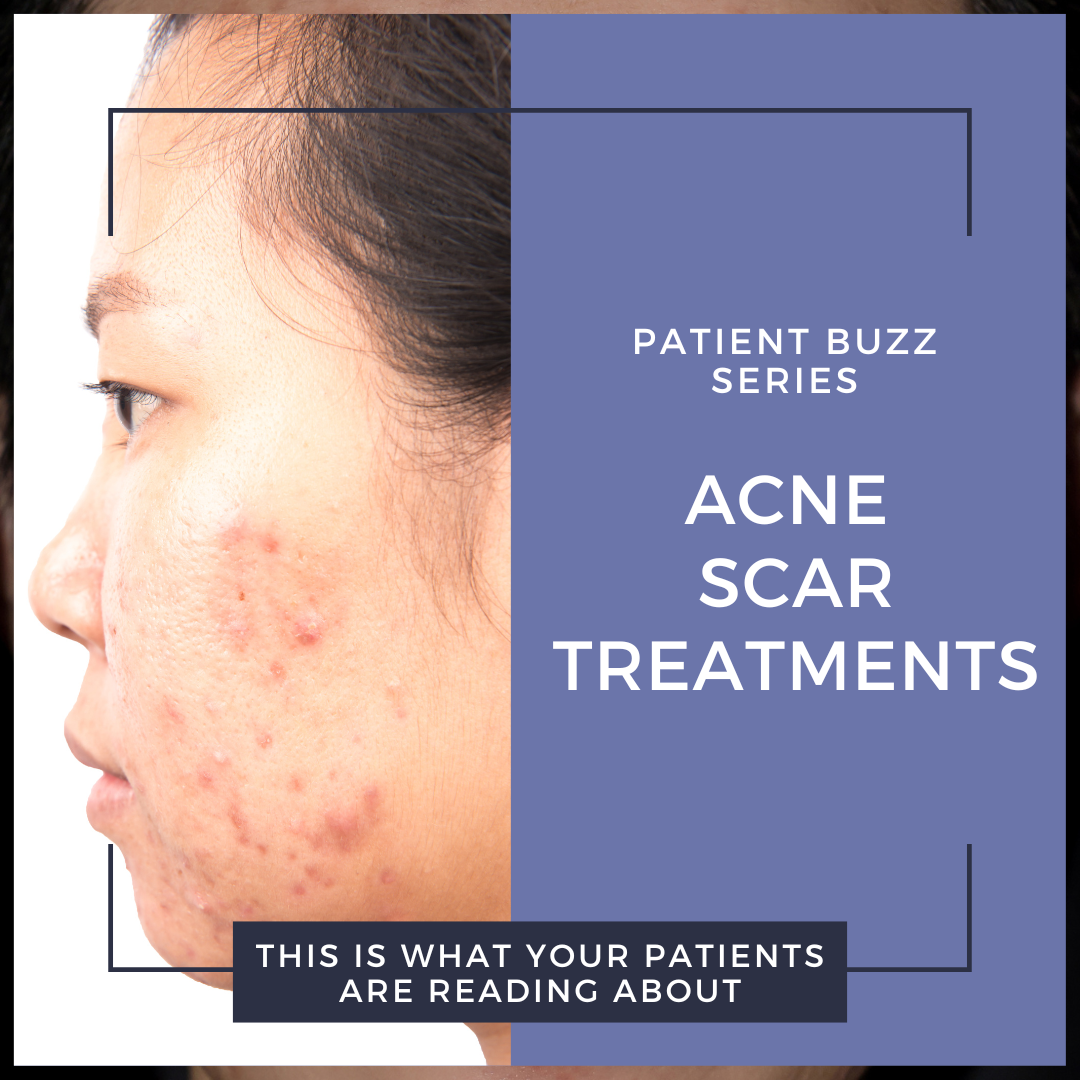 acne scars