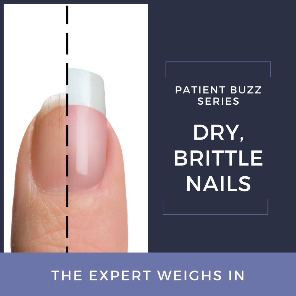 Patient Buzz Dry, Brittle Nails The Expert Weighs In Next Steps in