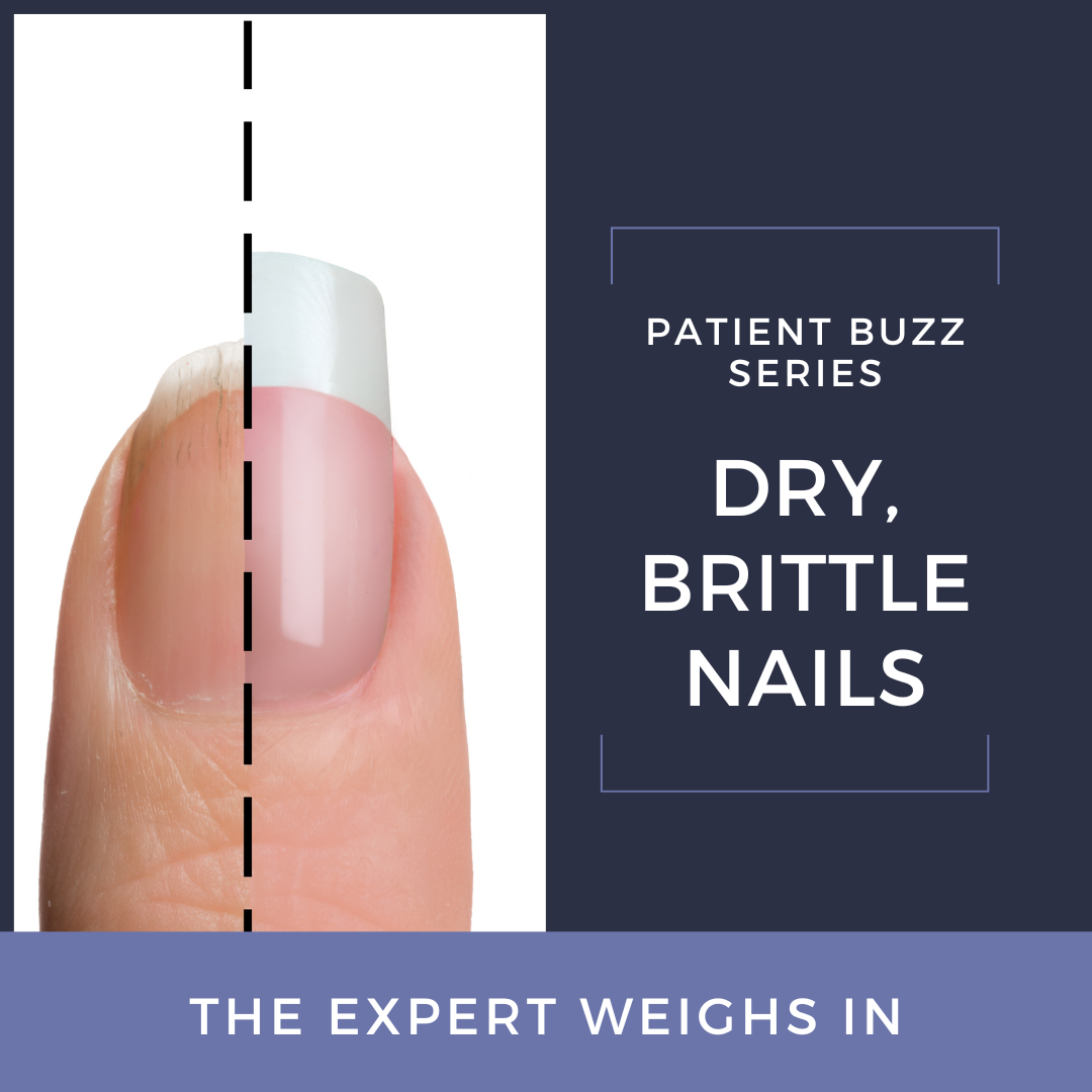 Beauty DIY: 3 Reasons For Brittle Nails