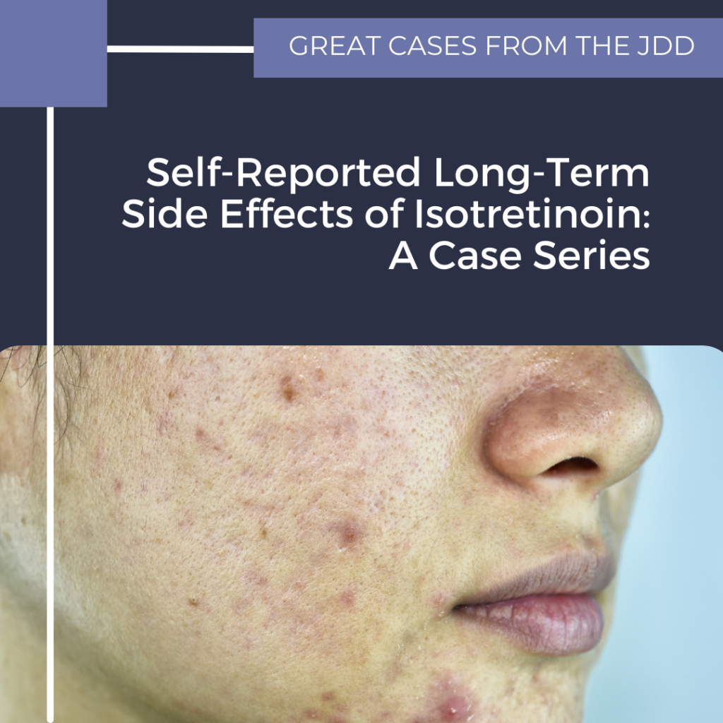 Self-Reported Long-Term Side Effects Of Isotretinoin: A Case Series ...