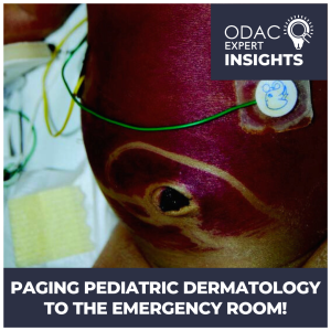 Pediatric Dermatology Emergencies