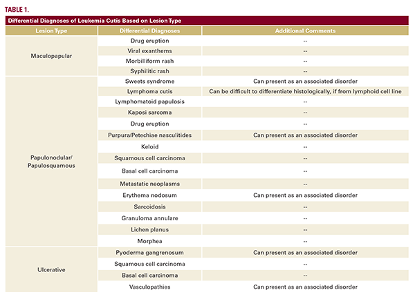 Leukemia Cutis