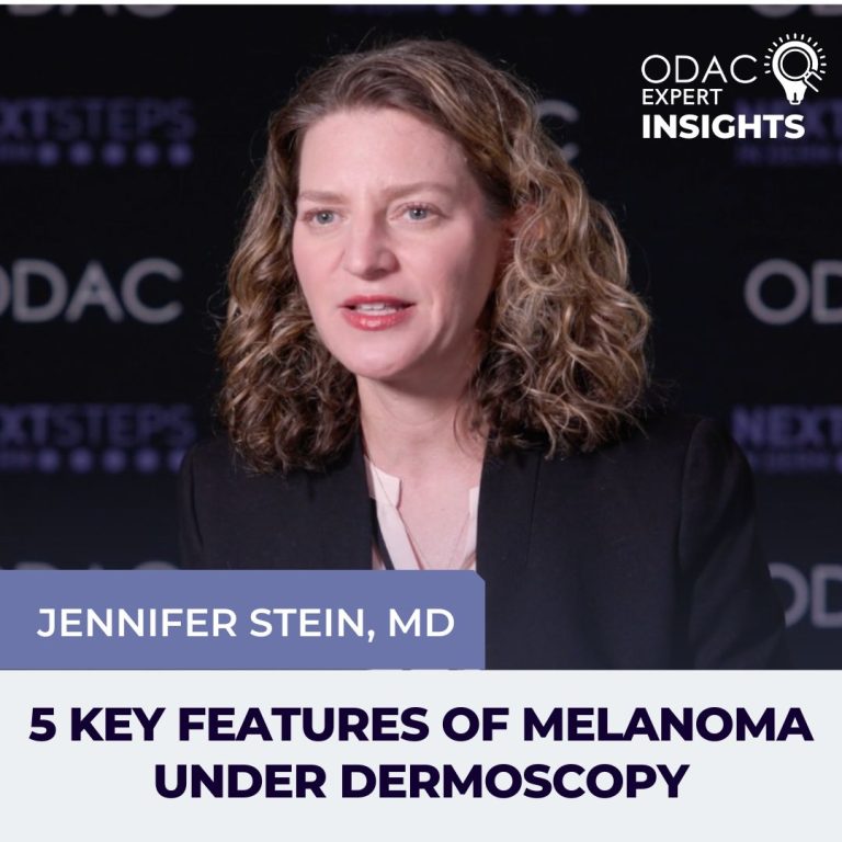 5 Key Features of Melanoma Under Dermoscopy - Next Steps in Dermatology