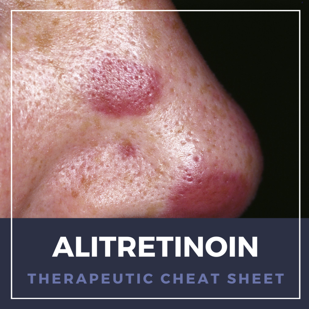 Alitretinoin Therapeutic Cheat Sheet Next Steps In Dermatology alitretinoin-therapeutic-cheat-sheet-next-steps-in-dermatology