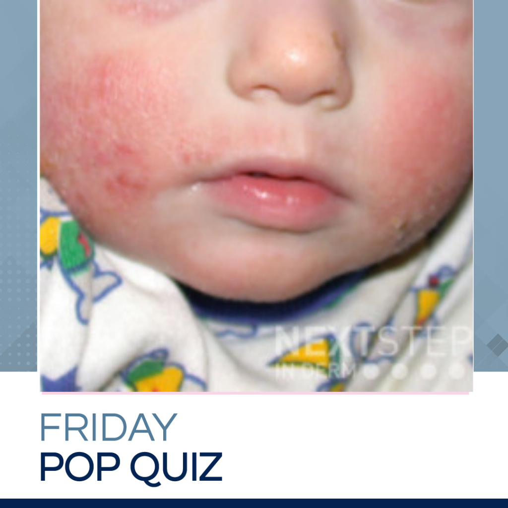 Derm InReview Archives Page 2 of 71 Next Steps in Dermatology