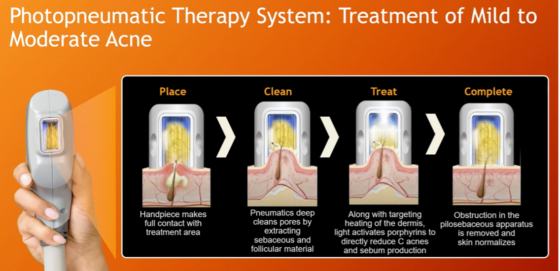 Photopneumatic Therapy