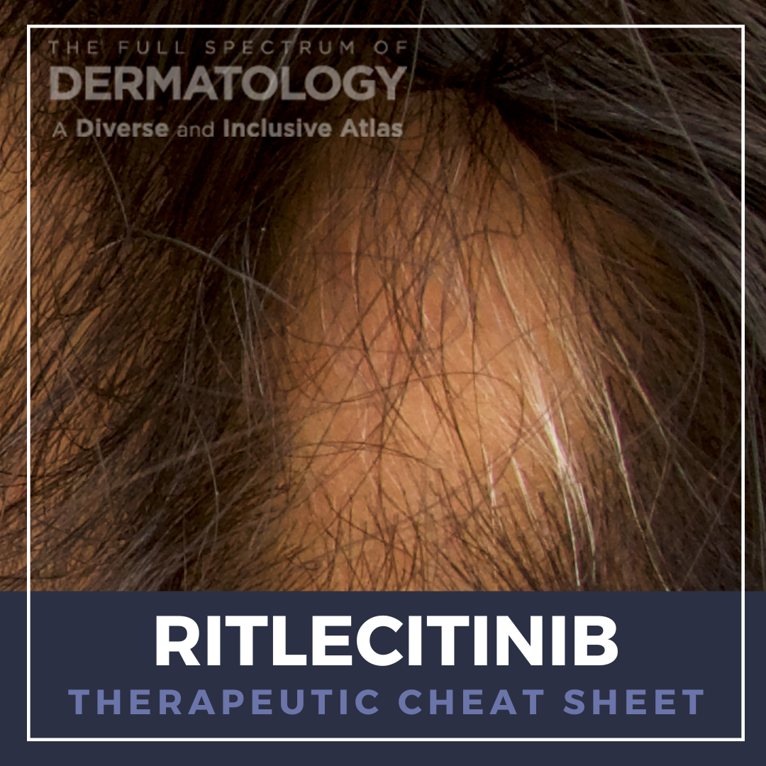 Ritlecitinib