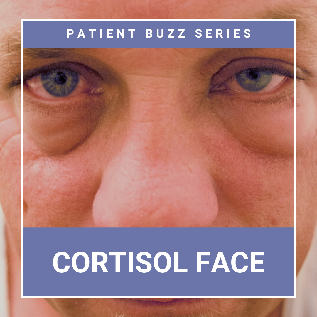 cortisol face