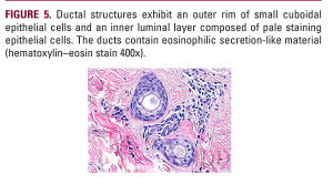 Syringoma