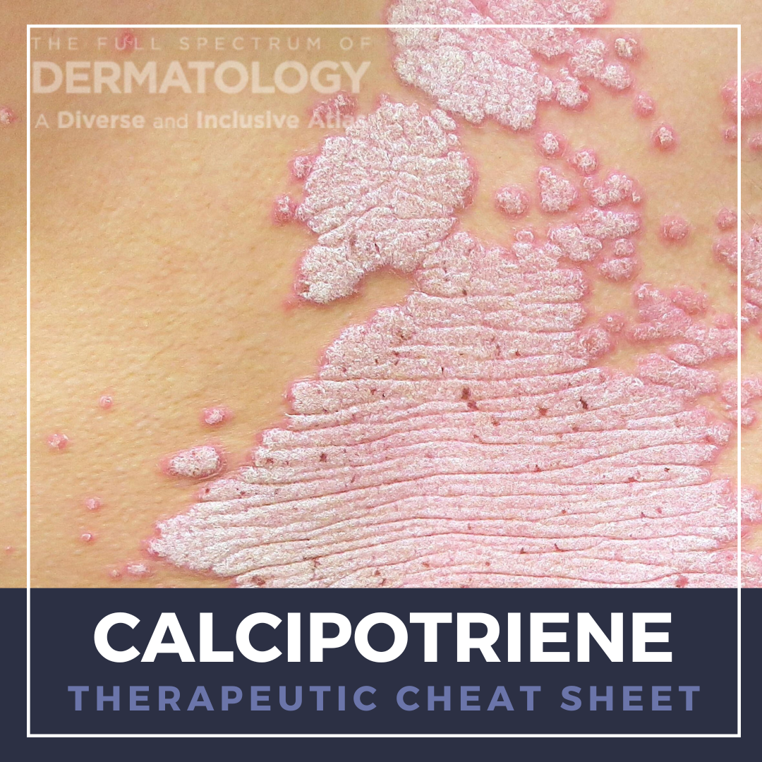 Calcipotriene