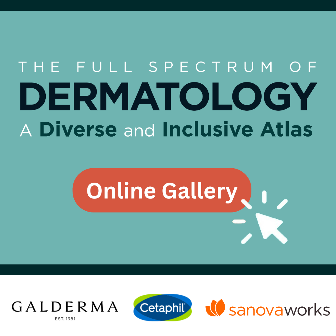 dermatology images