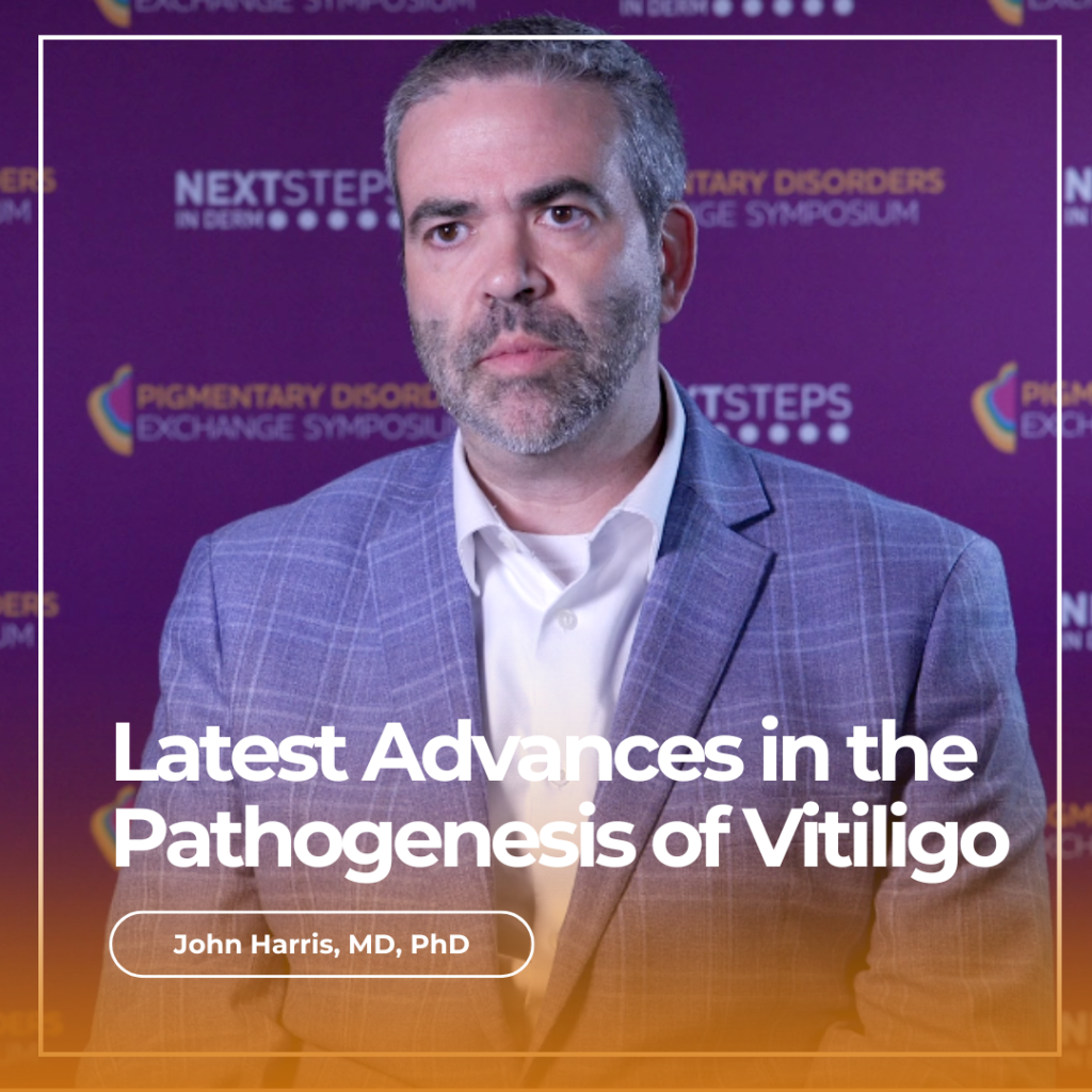 vitiligo-immune-response-archives-next-steps-in-dermatology