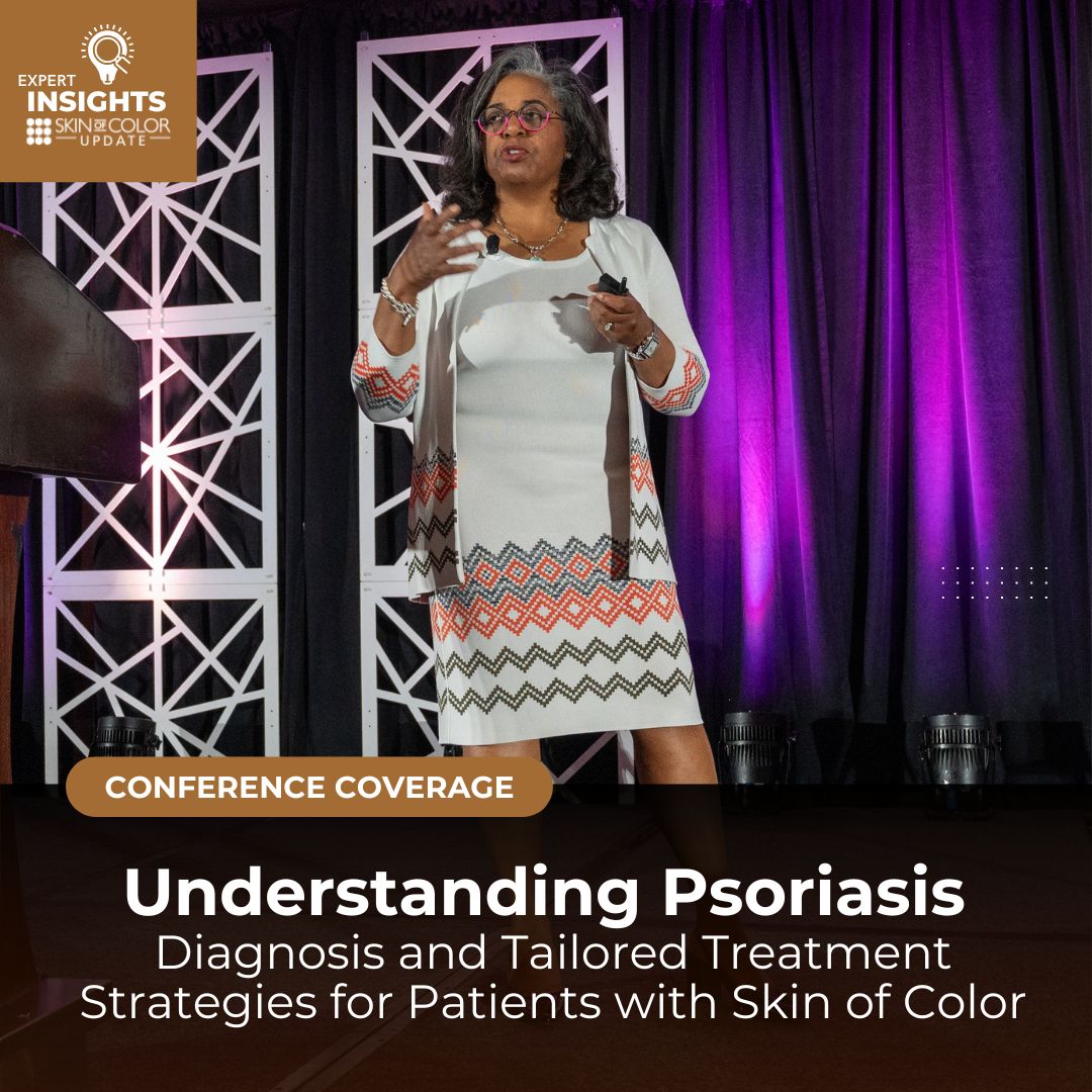 psoriasis