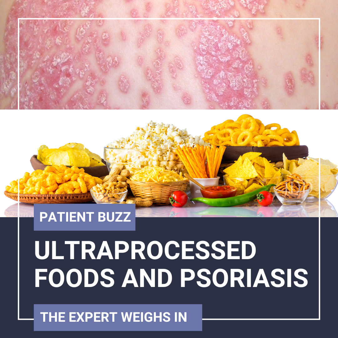 psoriasis