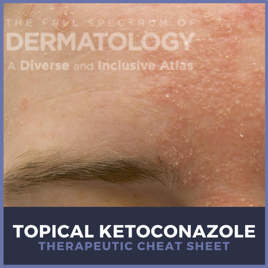 ketoconazole for skin conditions Archives - Next Steps in Dermatology