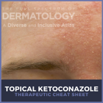 Topical Ketoconazole