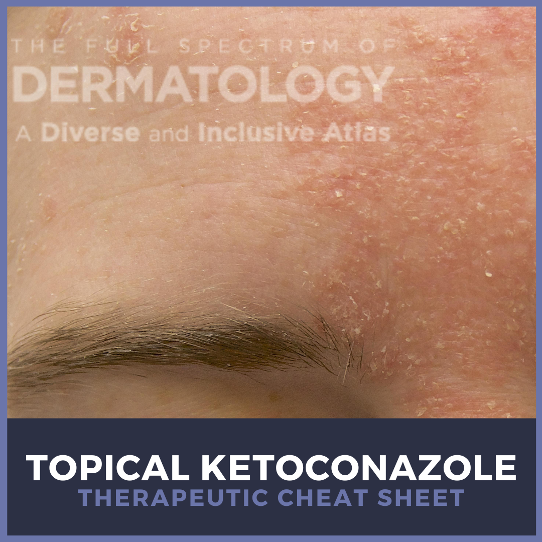 Topical Ketoconazole