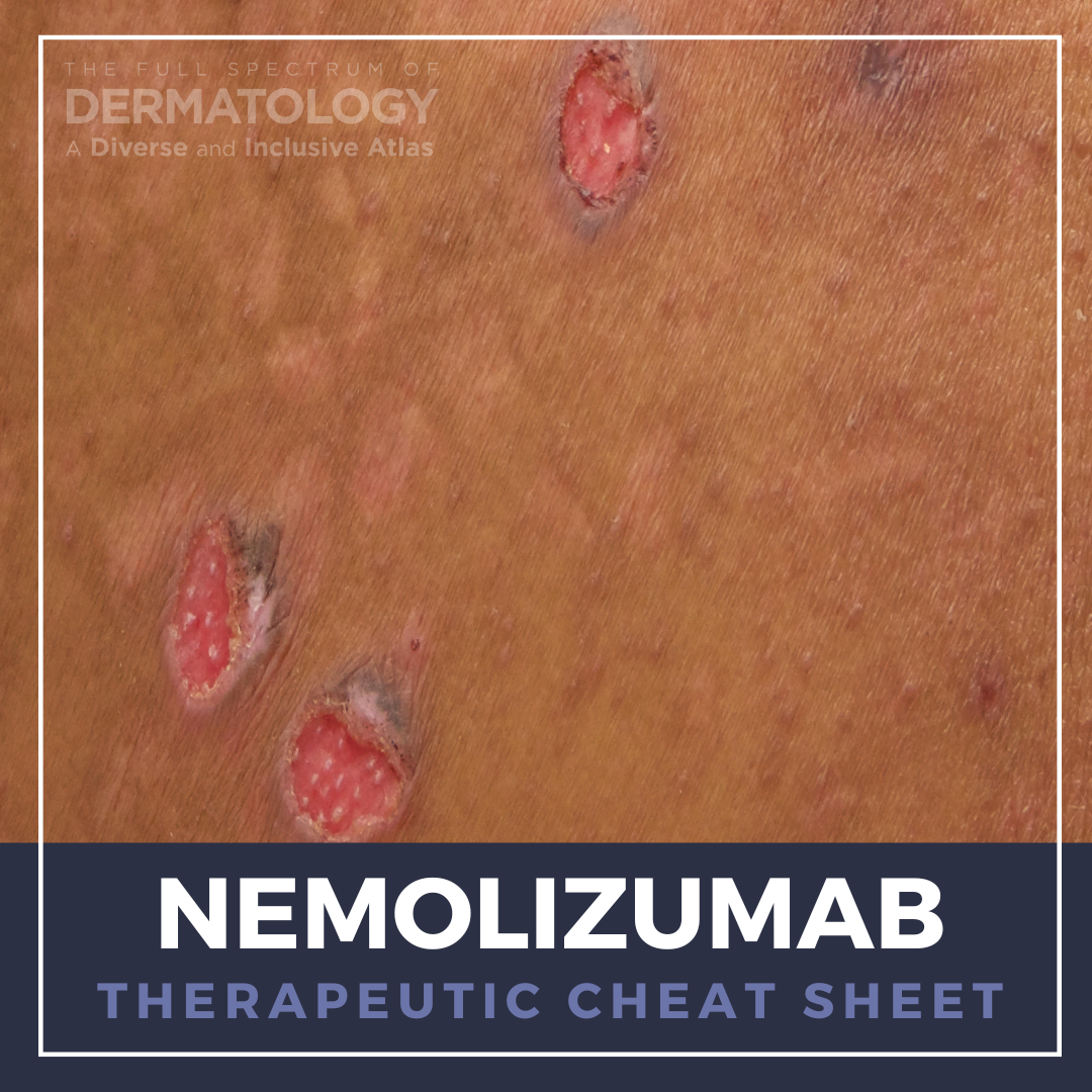 Nemolizumab