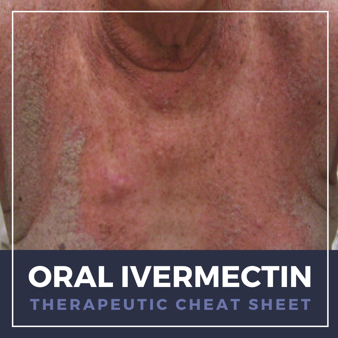 Oral Ivermectin