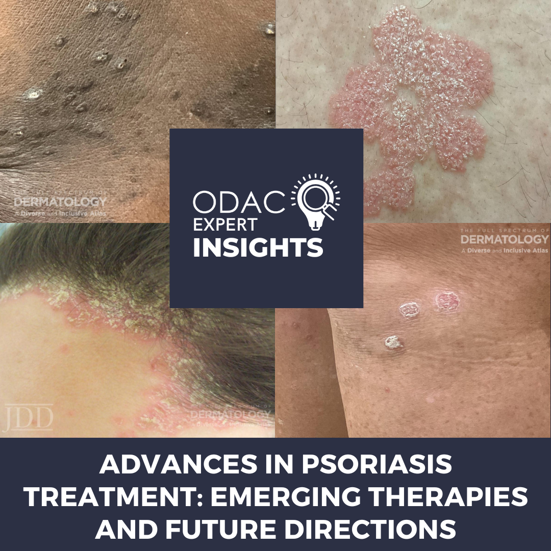 Sonelokimab Nanobody Archives Next Steps In Dermatology