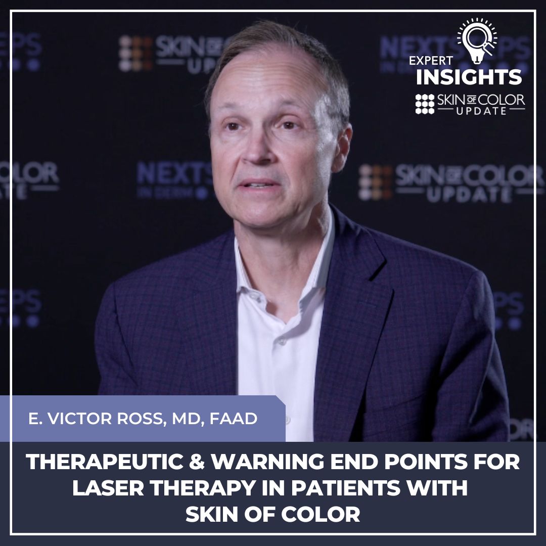laser therapy