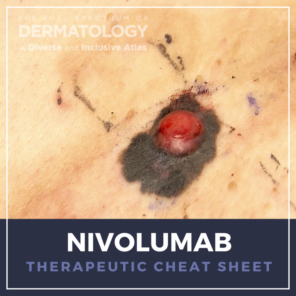 Nivolumab Therapeutic Cheat Sheet Next Steps In Dermatology