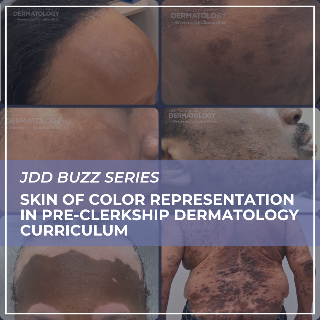 skin of color