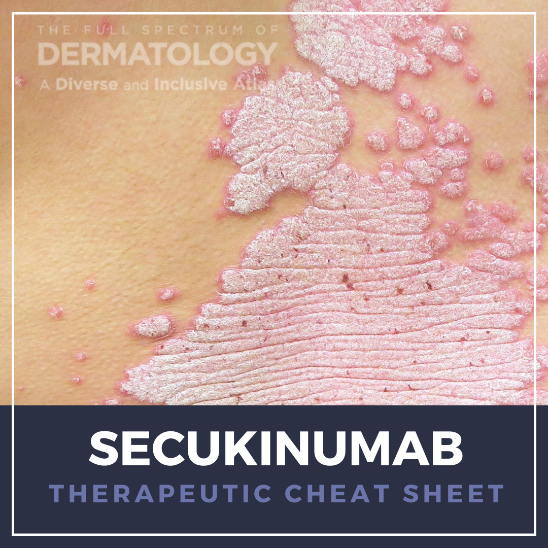 Secukinumab