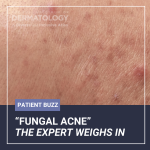 fungal acne