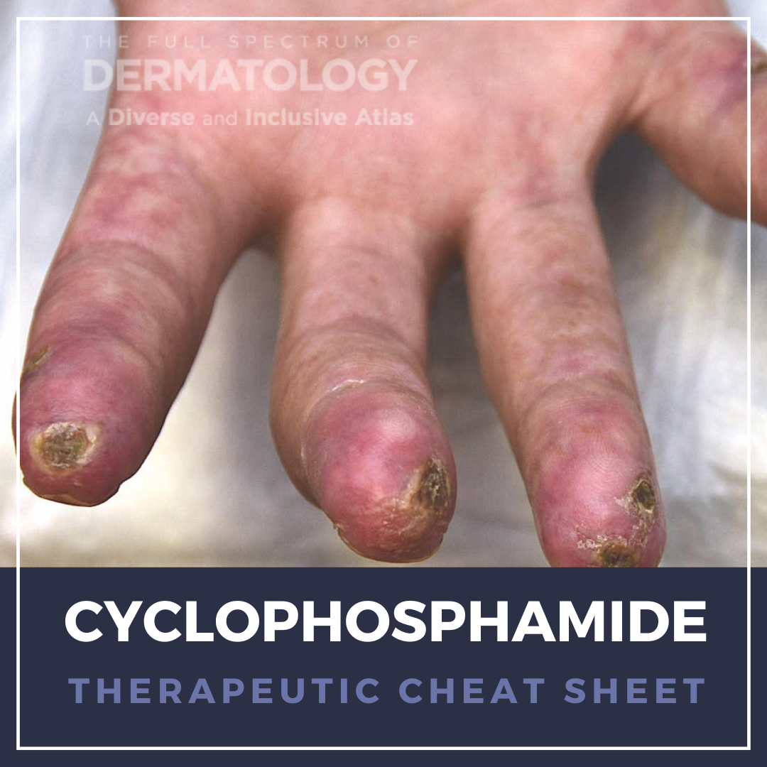 Cyclophosphamide