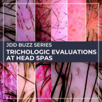 Trichologic Evaluations at Head Spas