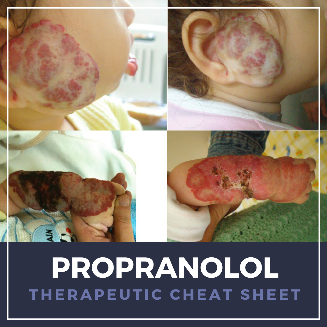 Propranolol