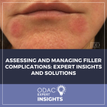 filler complications