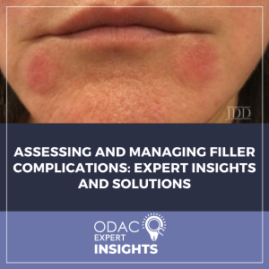 filler complications