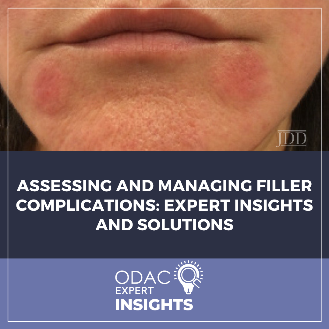 filler complications