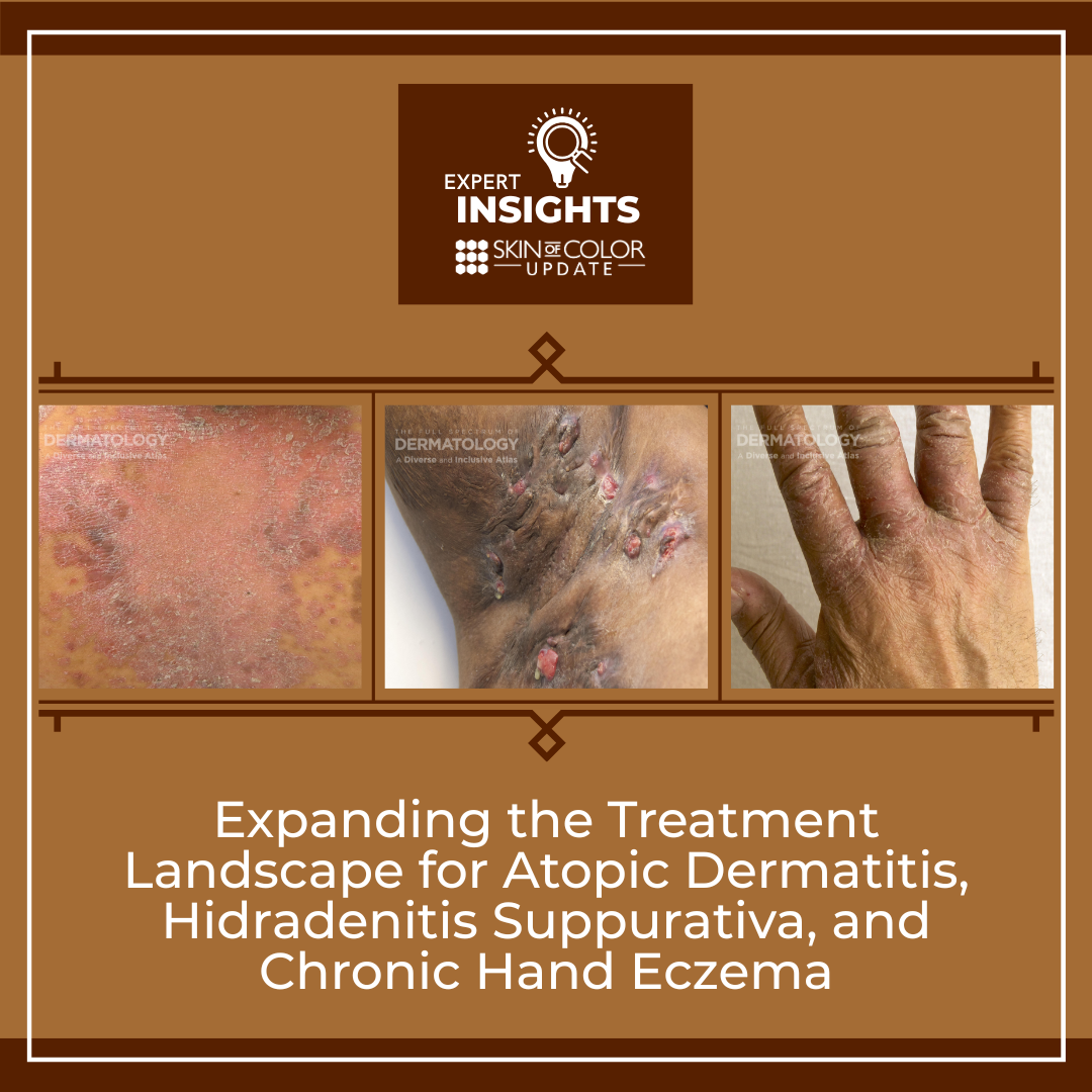 atopic dermatitis, eczema, hidradenitis suppurativa