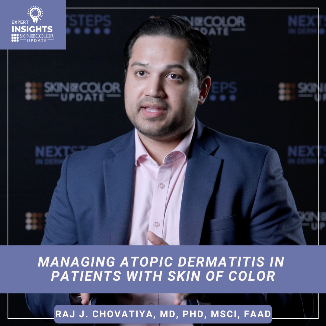 atopic dermatitis in skin of color