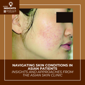 Asian Clinic_SOCU Skin Conditions in Asian Patients