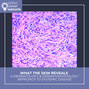 Systemic Disease