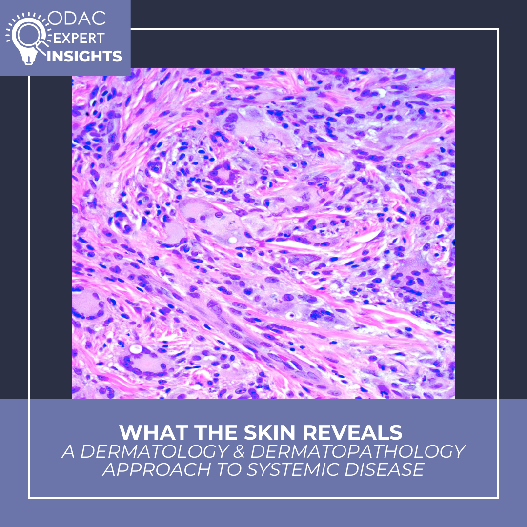 Systemic Disease
