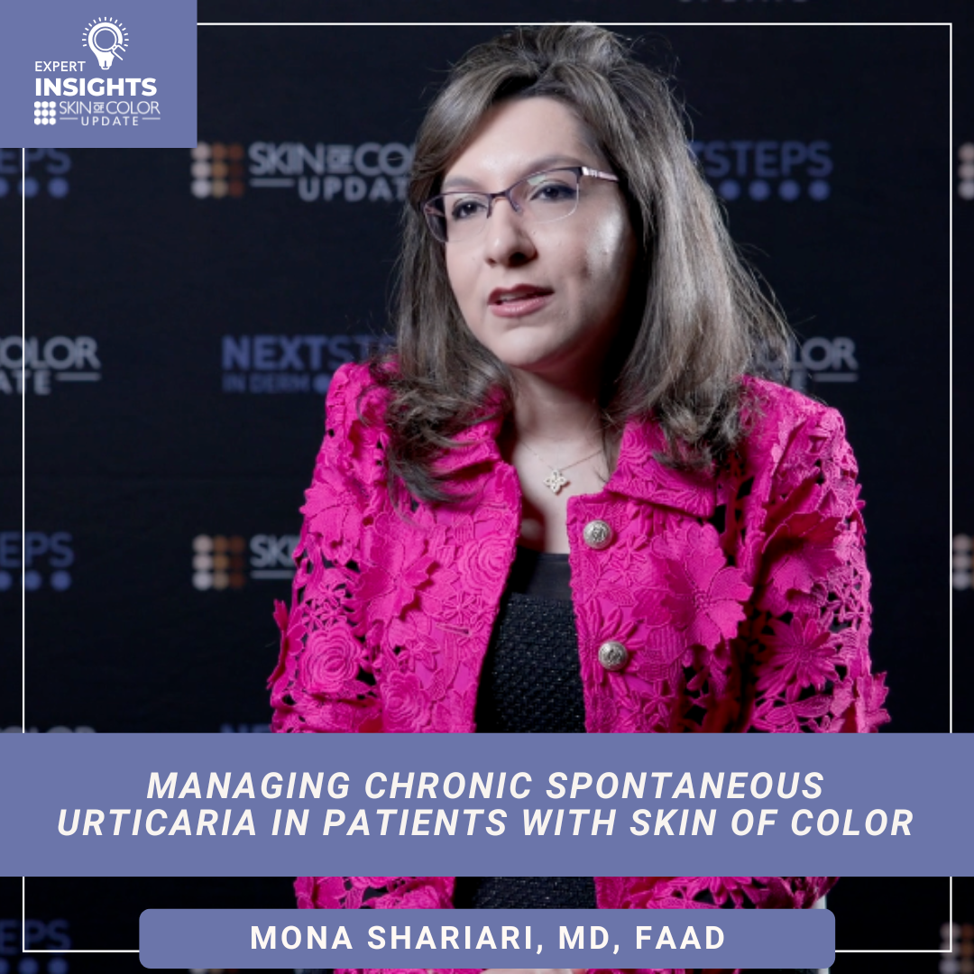 Chronic Spontaneous Urticaria (CSU)