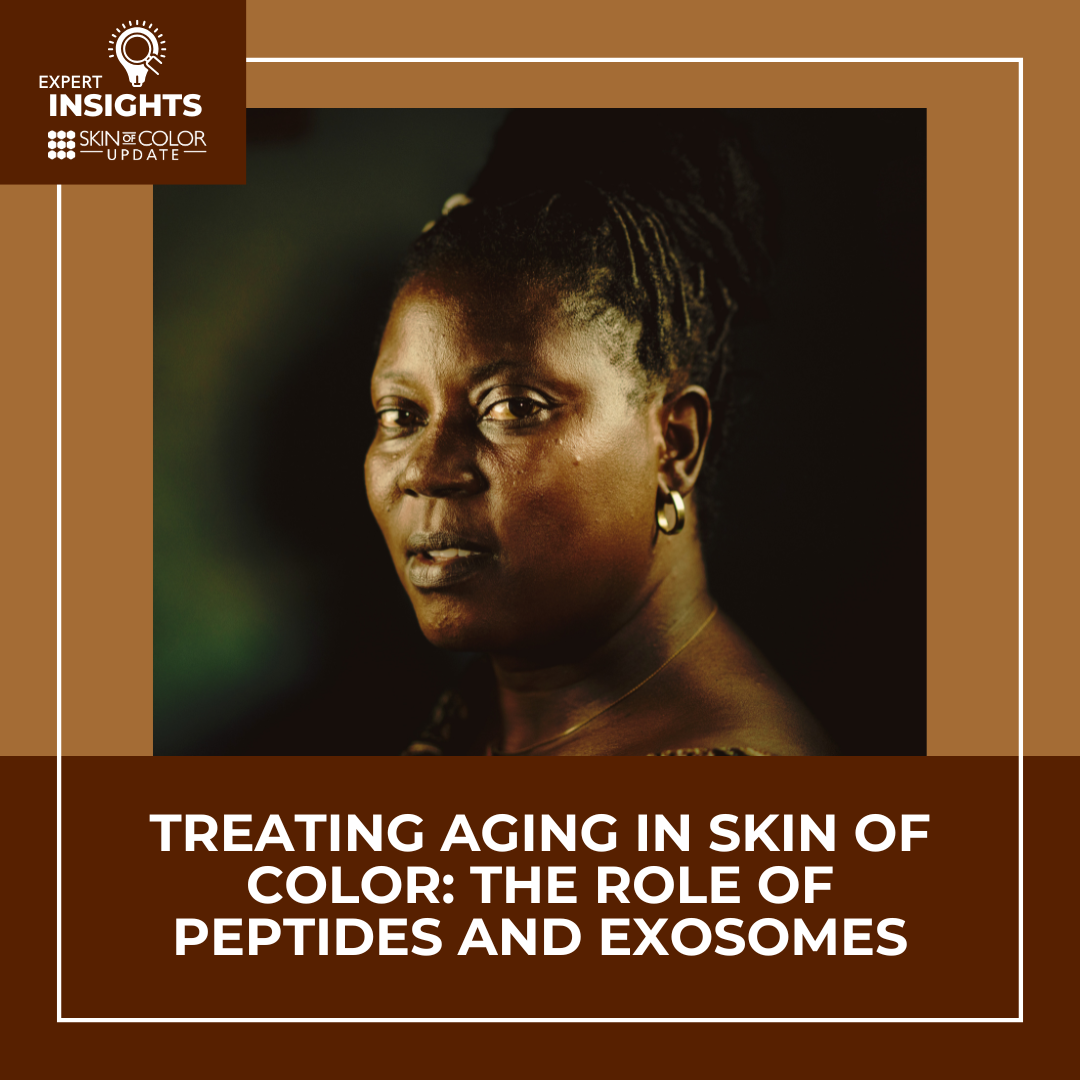 A mature woman with skin of color representing healthy aging and prejuvenation through cosmeceuticals and exosome therapy.