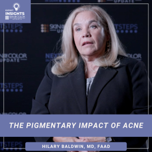 Dermatologist Dr. Hilary Baldwin discussing acne-induced hyperpigmentation treatment in skin of color.