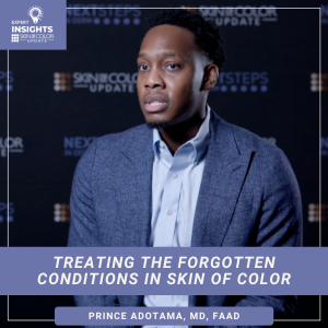 Dr. Prince Adotama, MD, FAAD, assistant professor at NYU Langone, discussing the treatment of acne keloidalis nuchae and dissecting cellulitis in an interview for Next Steps in Derm.