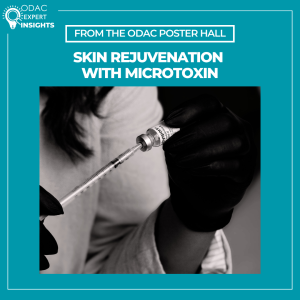 A syringe and vial of diluted botulinum toxin used for the microtoxin technique in aesthetic dermatology.
