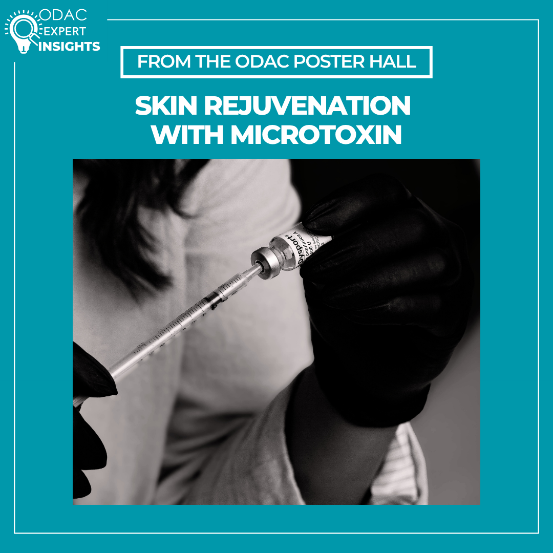 A syringe and vial of diluted botulinum toxin used for the microtoxin technique in aesthetic dermatology.