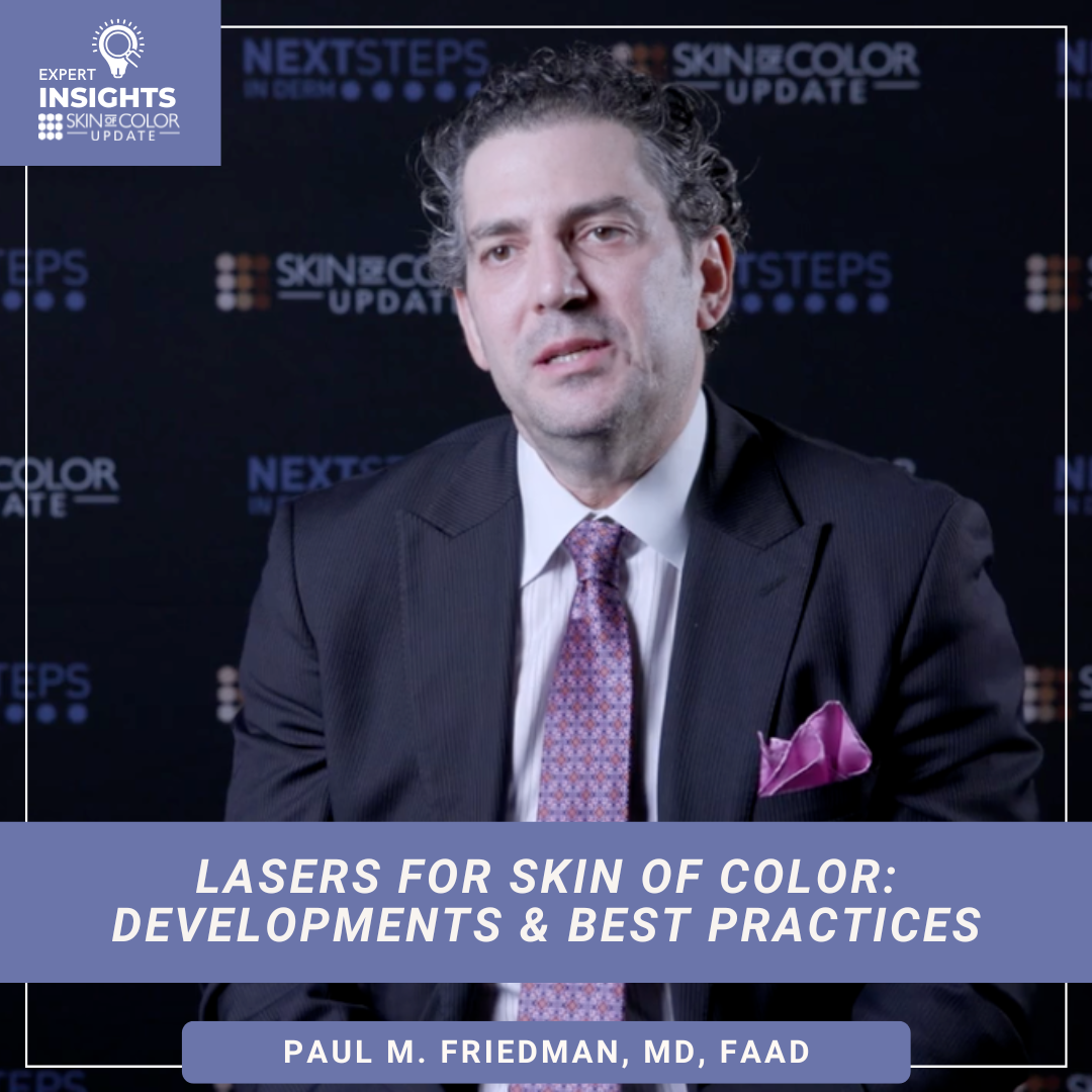 Lasers for skin of color