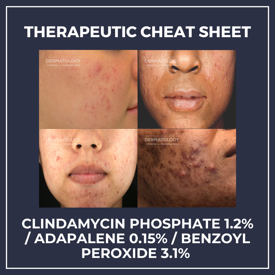 Cabtreo triple combination acne treatment
