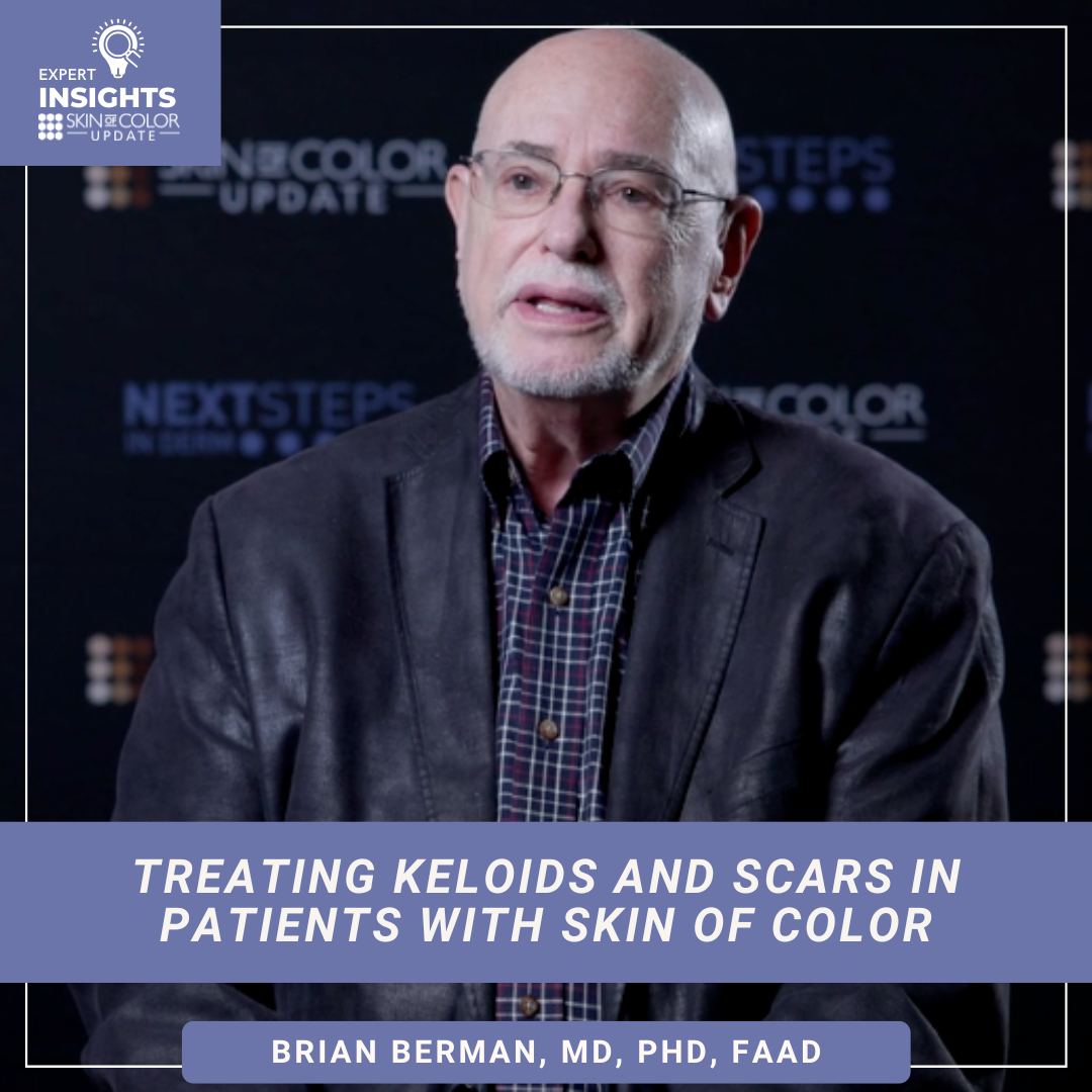Treating Keloids Skin of Color