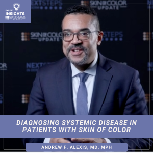 Systemic disease in skin of color